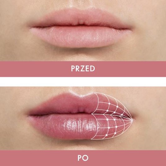 Pomalowane usta efekt przed i po